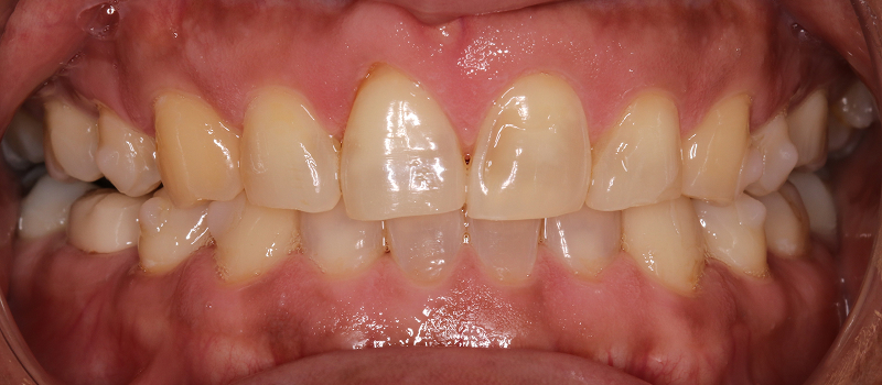 Before image