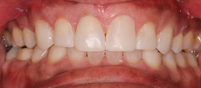 After image