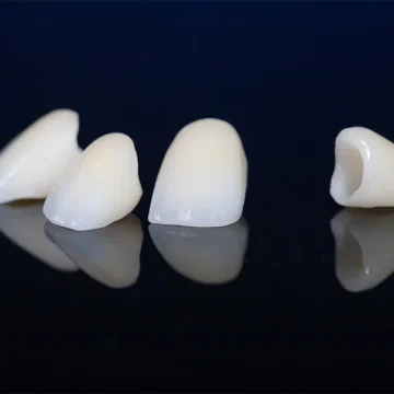 Everything You Need to Know About Getting a Dental Crown