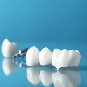 Benefits of Choosing Dental Crowns in Milford